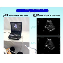 Doplerio ultragarso aparatas spalvotas