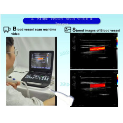 Doplerio ultragarso aparatas spalvotas