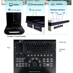 Doplerio ultragarso aparatas spalvotas