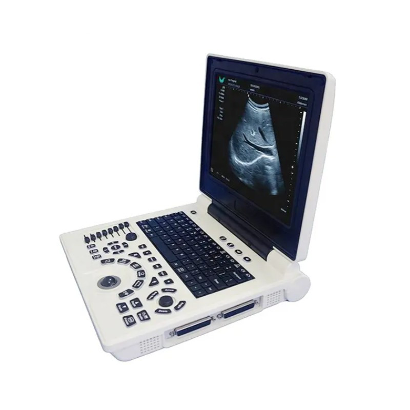 Medicininis nespalvotas ultragarsinis aparatas