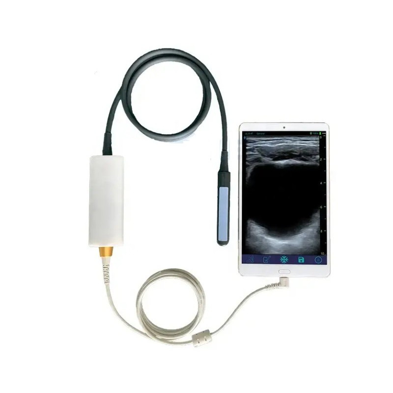 Gyvūnų tiesiosios žarnos ultragarso skeneris