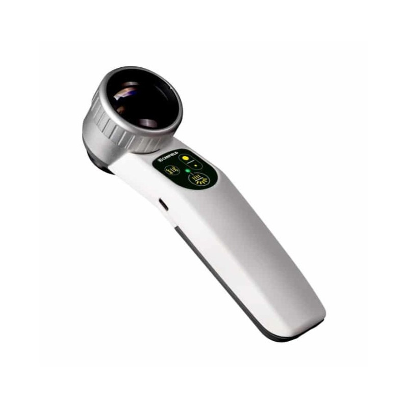 Nešiojamasis dermatoskopas