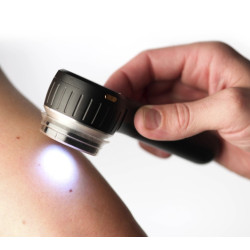 Dermatoskopas su poliarizuota ir nepoliarizuota šviesa