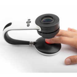 Dermatoskopas skirtas nagams