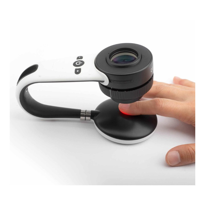 Dermatoskopas skirtas nagams