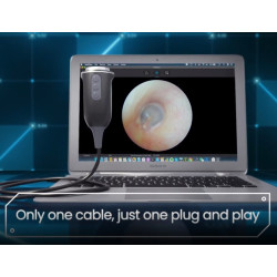 FullHD endoskopinė kamera UC-100