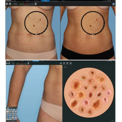 Viso kūno kartografavimo sistema