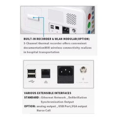 Kraujospūdžio, širdies ritmo, miego stebėjimo funkcijos