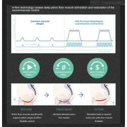 Ems dubens dugno raumenų reabilitacijos kėdė
