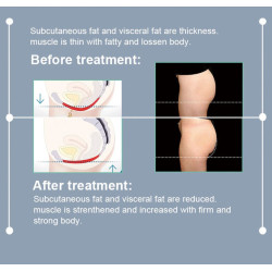 Ems dubens dugno raumenų reabilitacijos kėdė