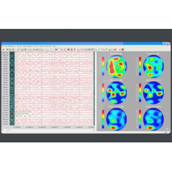 EEG 32 kanalų skaitmeninis elektroencefalografas
