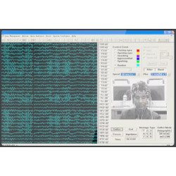 EEG 32 kanalų skaitmeninis elektroencefalografas