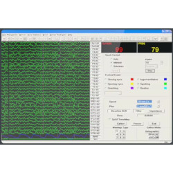EEG 32 kanalų skaitmeninis elektroencefalografas