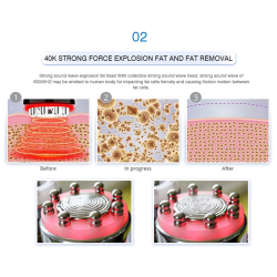 Kavitacijos  RF BIO Lazerio aparatas