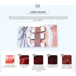 Kavitacijos  RF BIO Lazerio aparatas