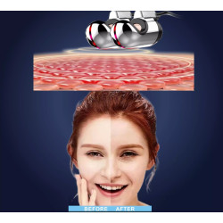 Vakuumo kavitacijos RF fizinės terapijos įranga 3 in 1